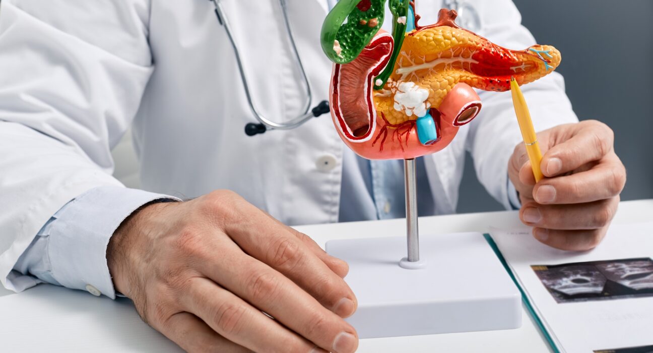 Treatment of pancreatic diseases, acute and chronic pancreatitis. Doctor showing pancreatic disease