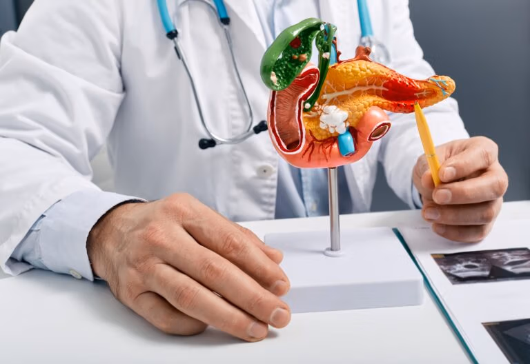 Treatment of pancreatic diseases, acute and chronic pancreatitis. Doctor showing pancreatic disease