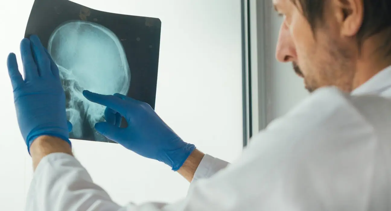 Doctor examining x-ray of the skull