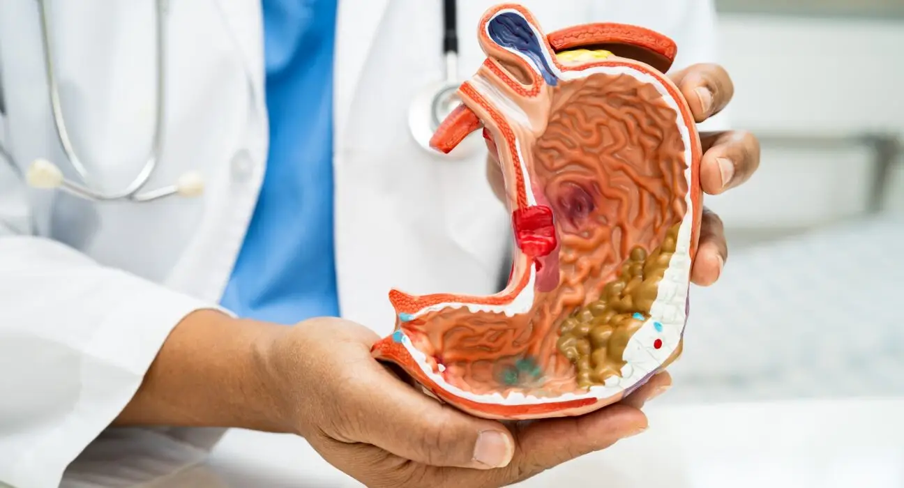 Stomach disease, doctor with anatomy model for study diagnosis and treatment in hospital.