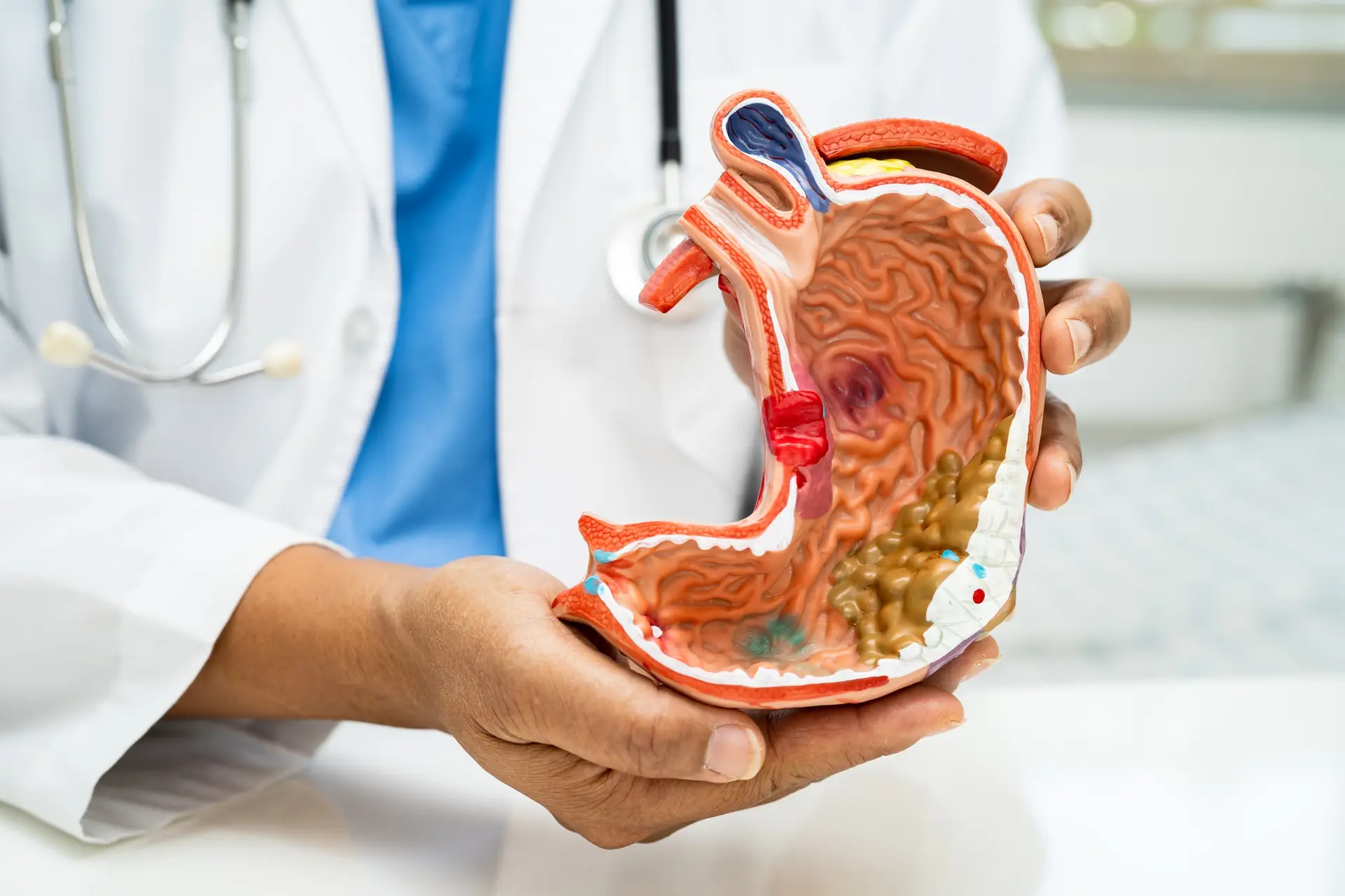 Stomach disease, doctor with anatomy model for study diagnosis and treatment in hospital.