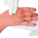 Signs of Swollen Hands: Early Clues, Causes, and When to Seek Help [2025 Updated]