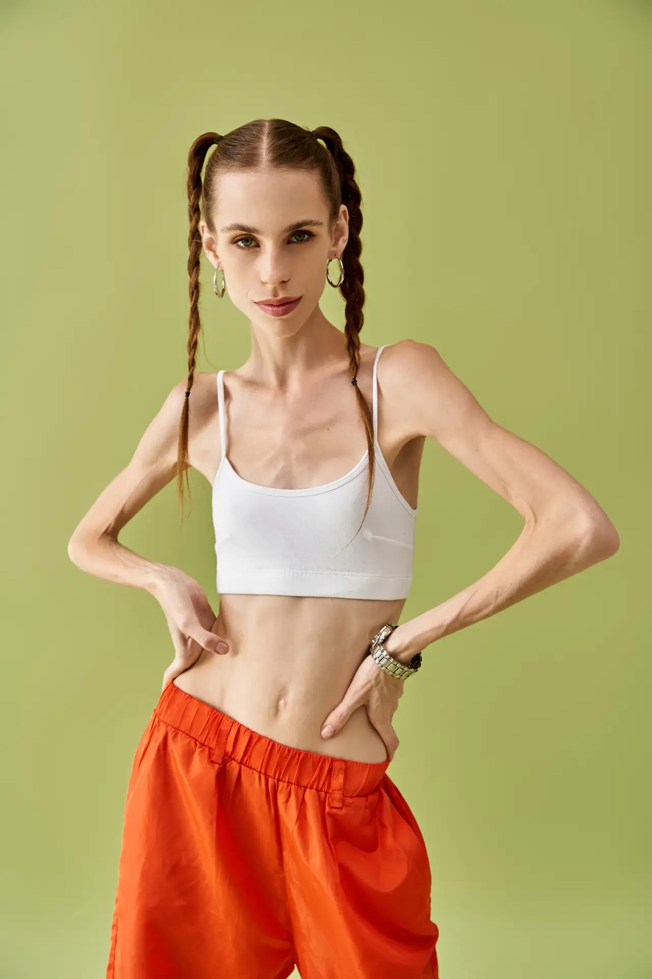 Young woman expressing her struggle with anorexia in a colorful setting