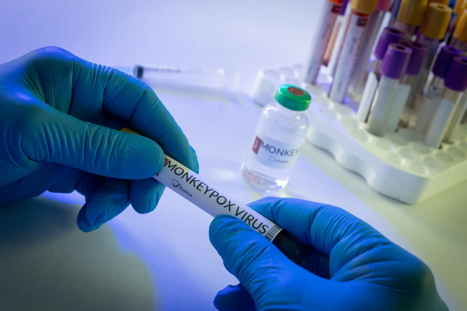 Hands of doctor holding vial with monkeypox virus