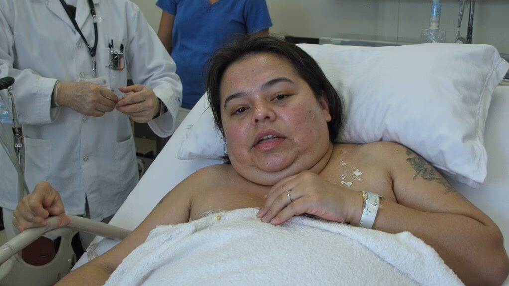 acute hyponatremia causes encephalopathy