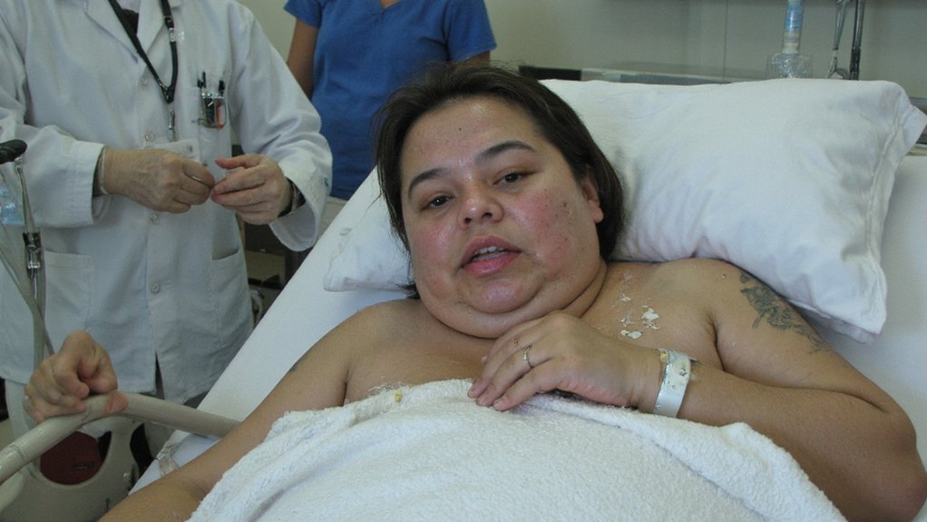 acute hyponatremia causes encephalopathy