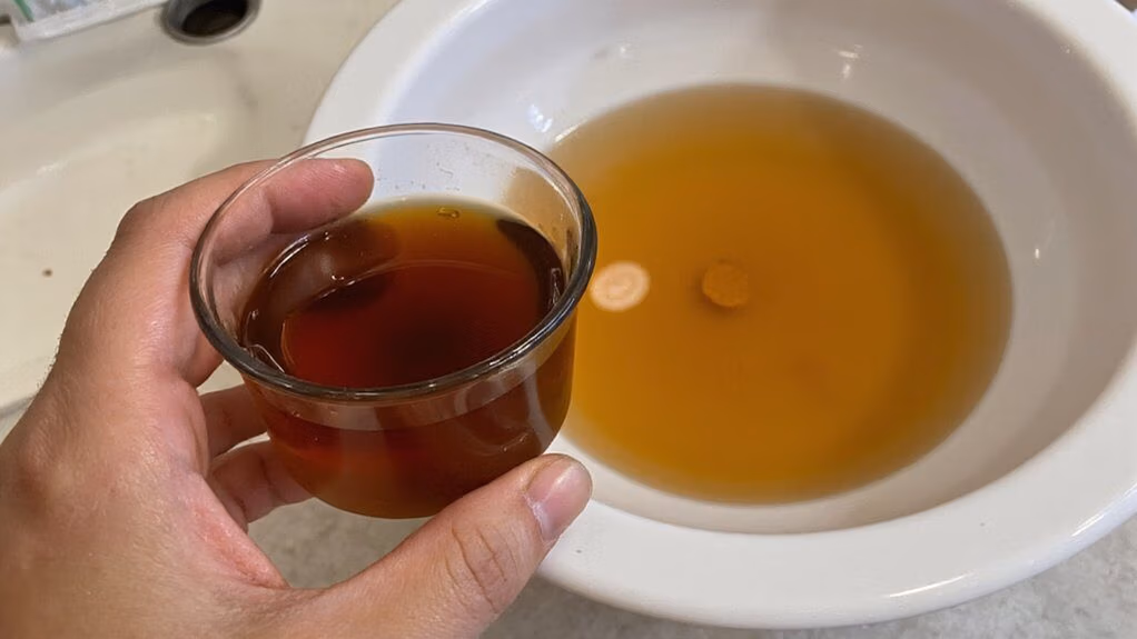 concentrated urine indicates dehydration