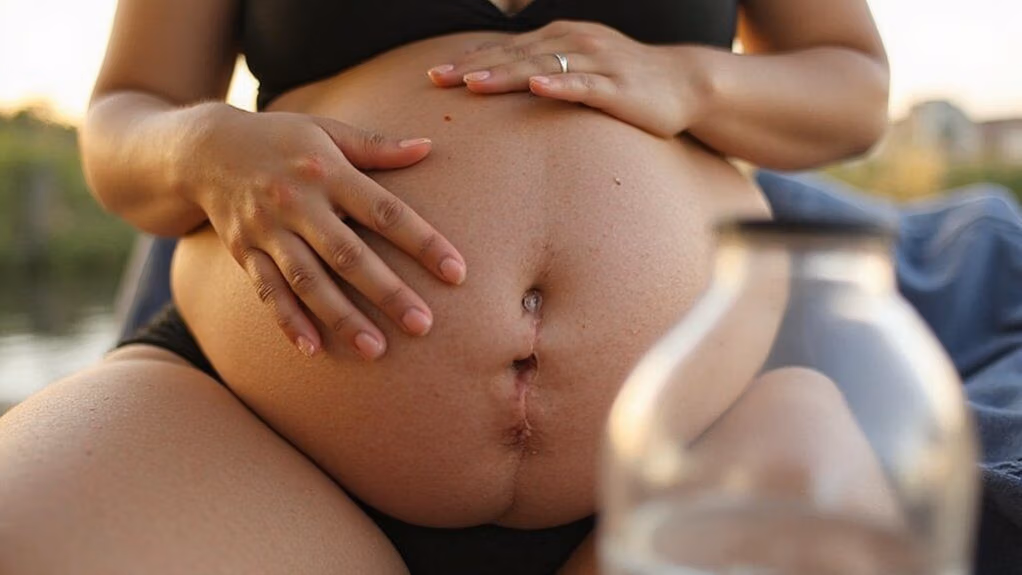 dehydration symptoms in pregnancy