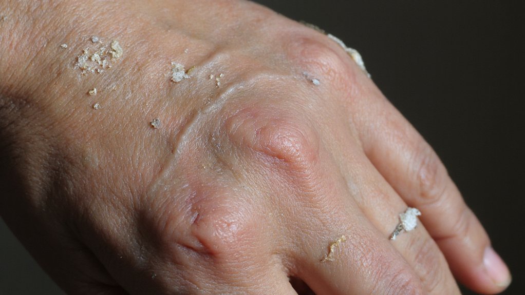 dry flaky tight skin