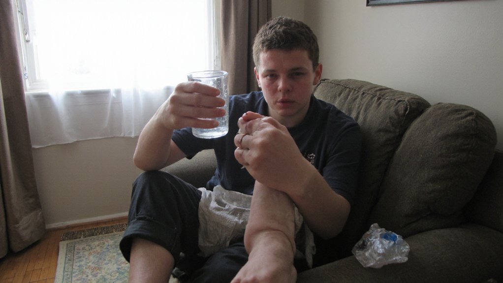 early dilutional hyponatremia symptoms