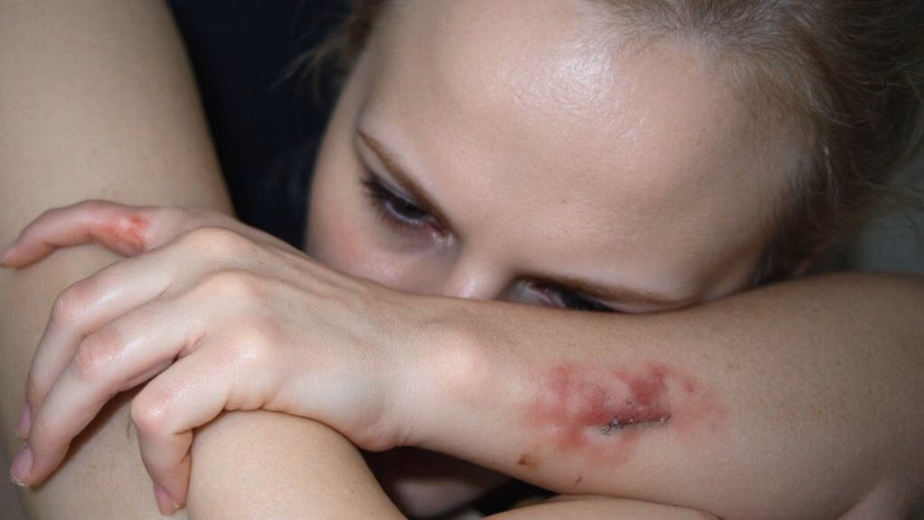 low vitamin d symptoms