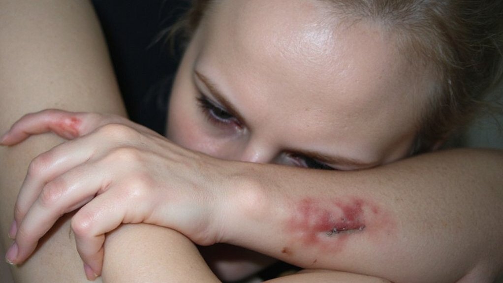 low vitamin d symptoms