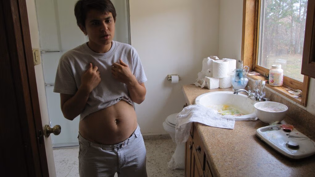 probiotic trial for dysbiosis