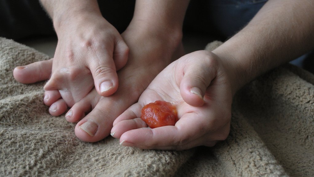 b12 deficiency peripheral neuropathy