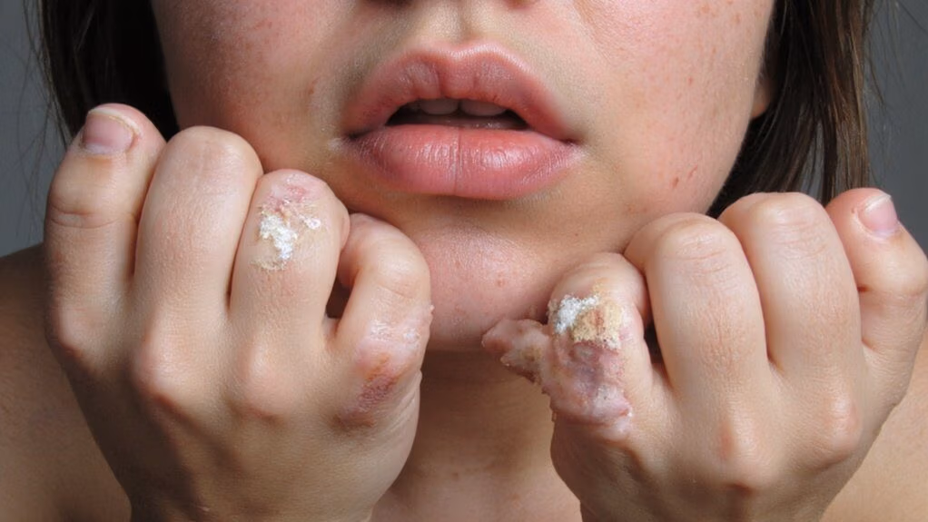 infections poor healing dermatitis
