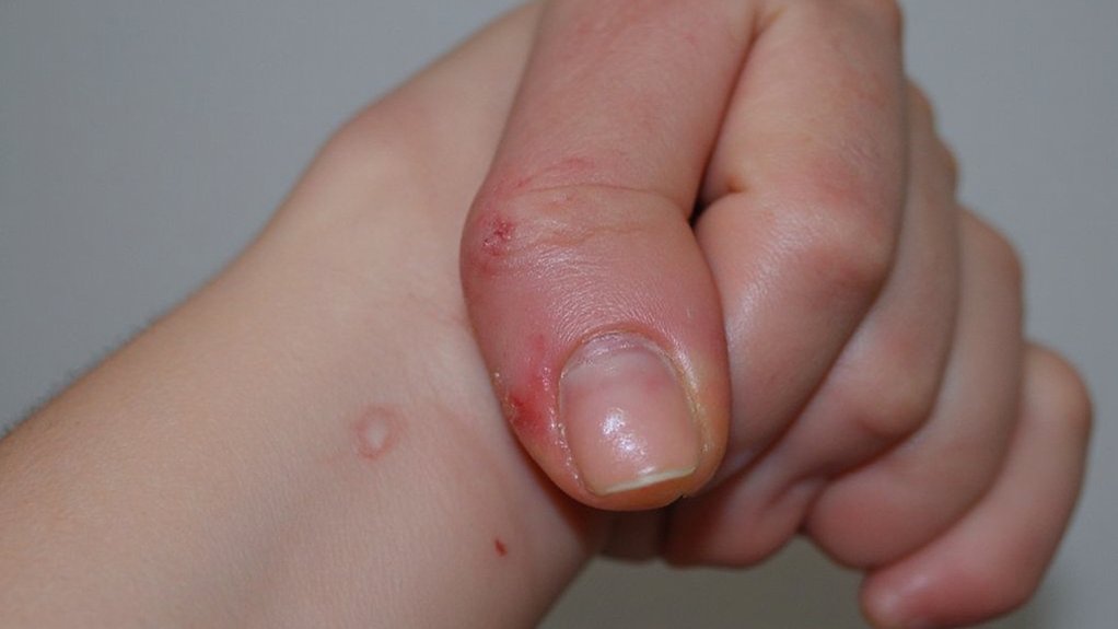 signs of chronic inflammation signs of chronic inflammation