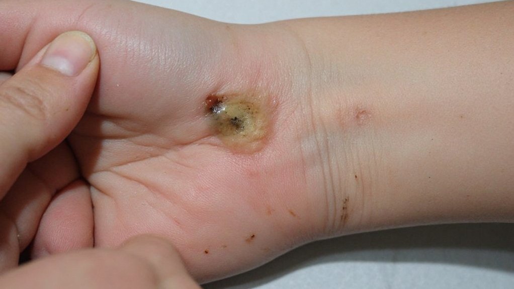 typical symptoms of diabetes