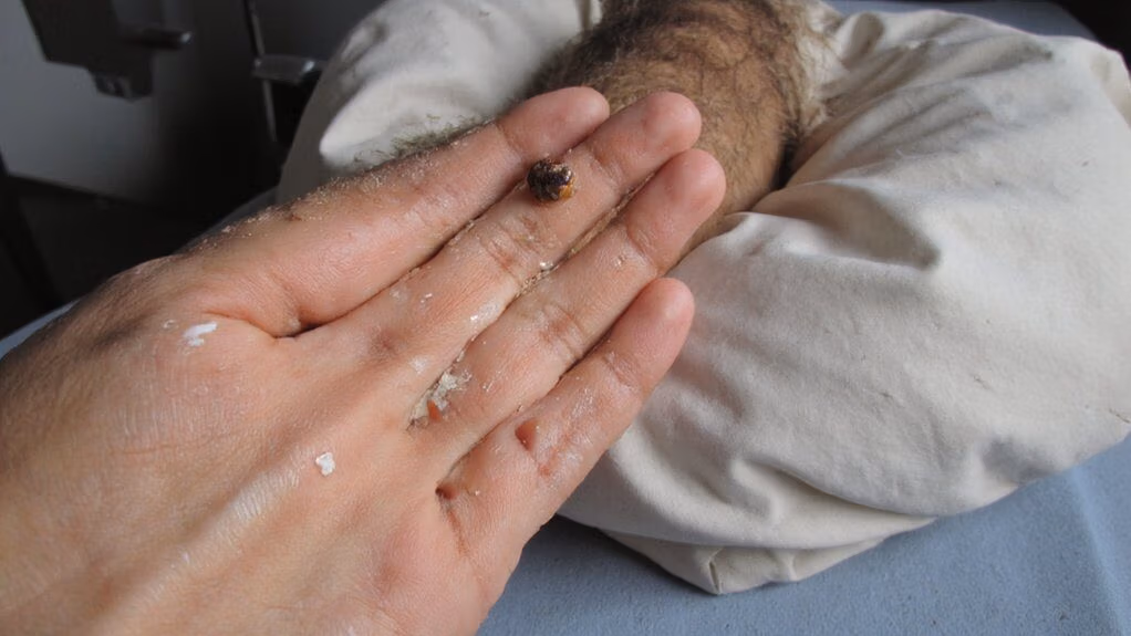 zinc enzymatic immune regulatory