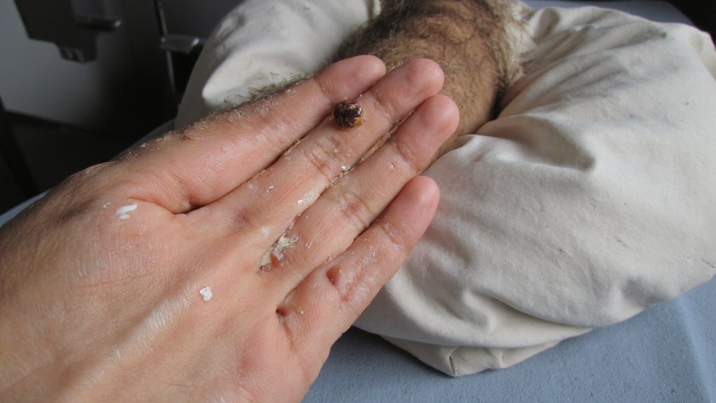 zinc enzymatic immune regulatory